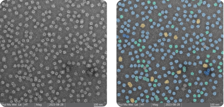 NanoSMART, an AI cryoEM system, automatically identifies nanoparticle features in images from various electron microscopes